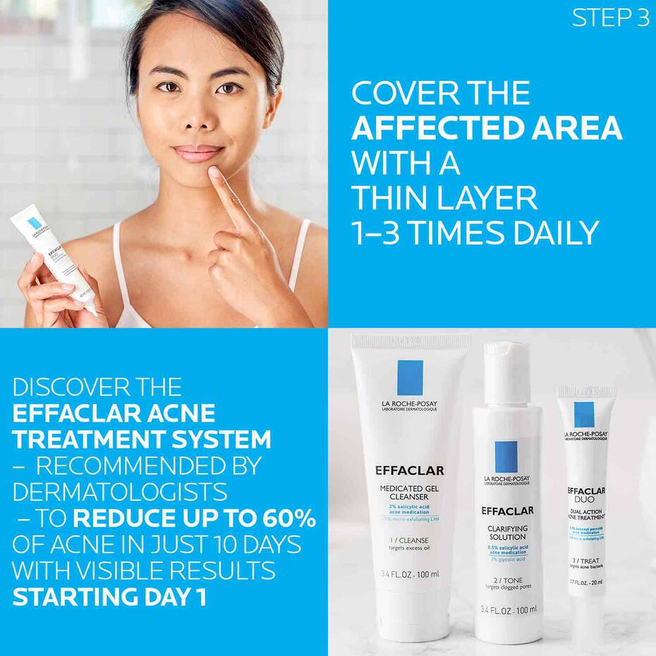 LA ROCHE-POSAY EFFACLAR ACNE TREATMENT SYSTEM